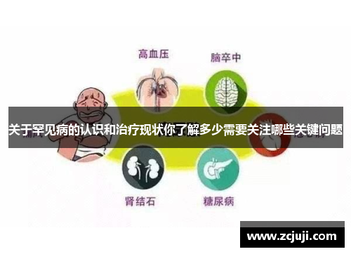 关于罕见病的认识和治疗现状你了解多少需要关注哪些关键问题 关于罕见病的认识和治疗现状你了解多少需要关注哪些关键问题